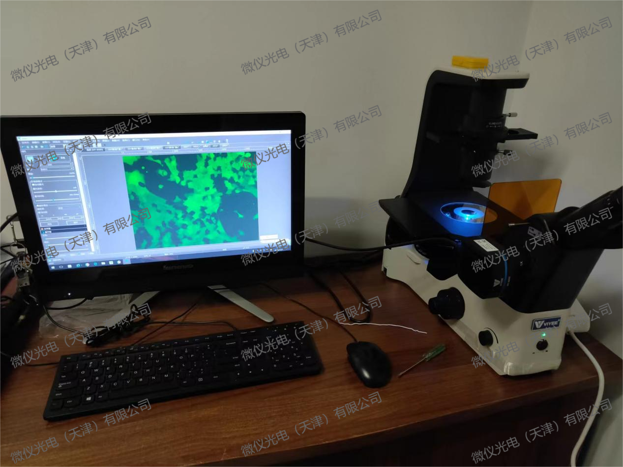 Nankai University People's Hospital purchased the WYS-41XDY for fluorescence observation of stained tissues